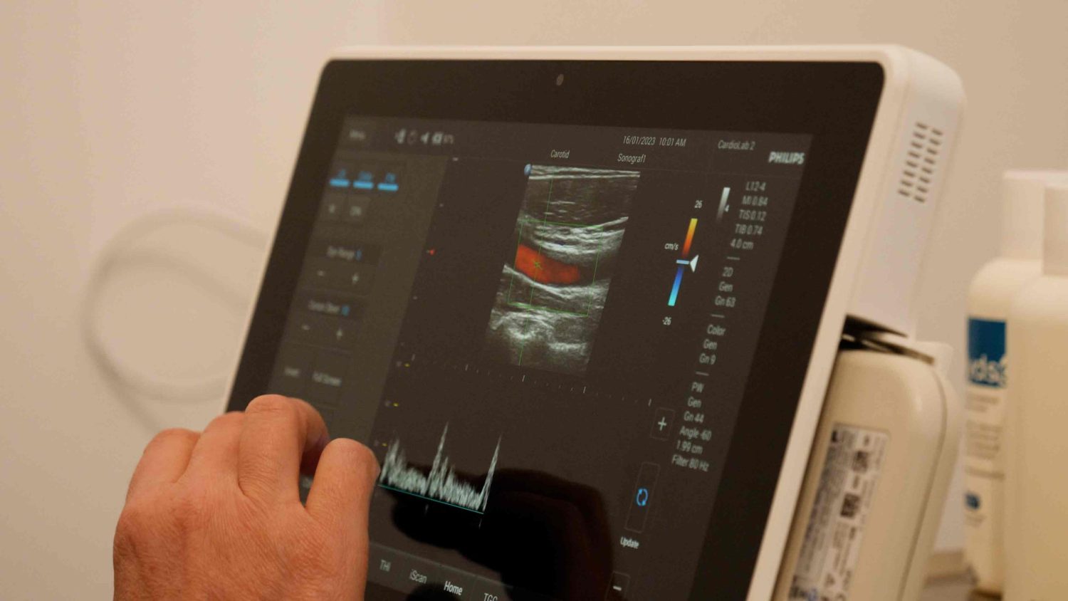 Et billede af et hjerteundersøgelse med en synlig halspulsåre på skærmen